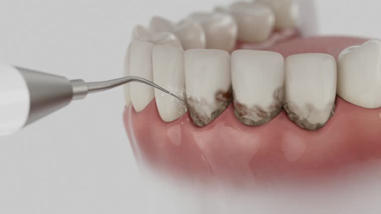 Reliable Root Canal Treatment contractor in Yancey County County, NC by Dentist Open Now